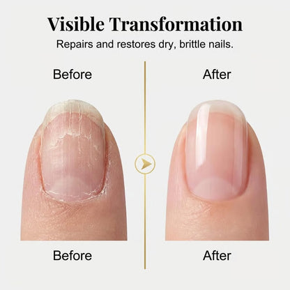 3 Days Nail Care, Keratin Amino Acid Nail Care, Strengthening and Hydration, for Dry, Weak & Fragile Nails