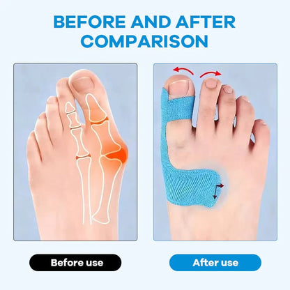 👣Cinta de Kinesiología Precortada para Corrector de Juanetes