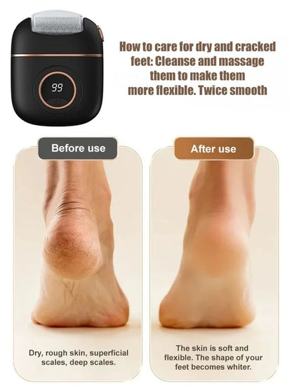 🔥2026🔥 New digital electric foot polishing machine