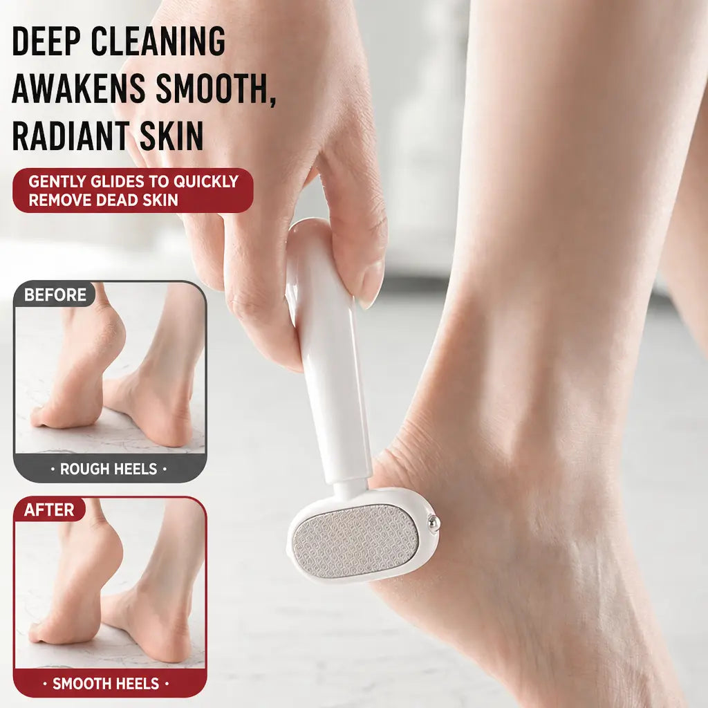 Dual-Sided Foot Callus Remover 👣