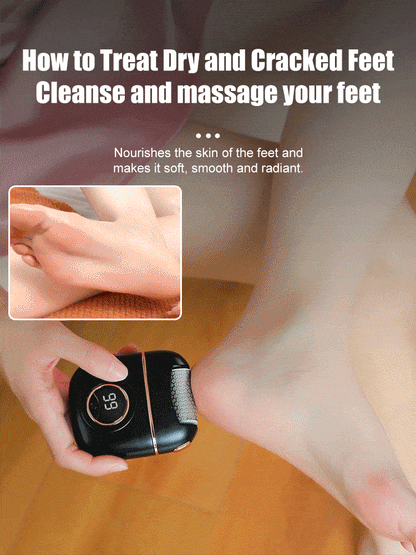🔥2026🔥 New digital electric foot polishing machine