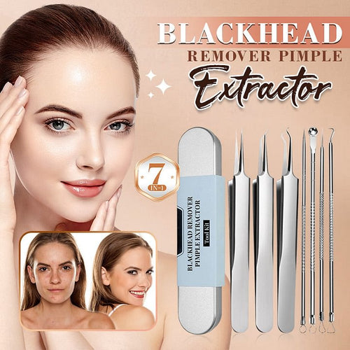 💓Last day discount💥Blackhead cytokine tweezers kit