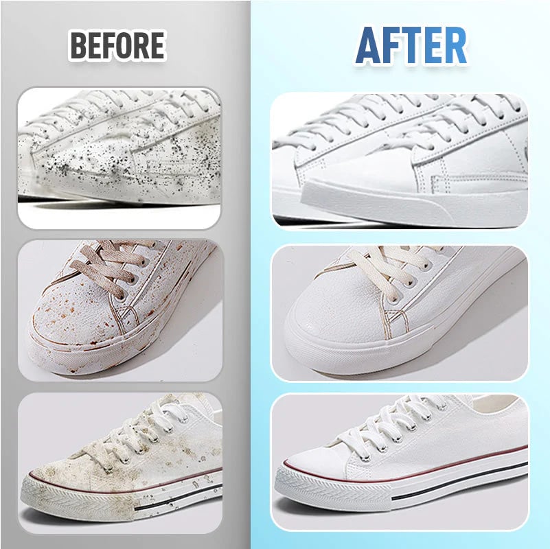 💖Quick-Clean Shoe Wipes
