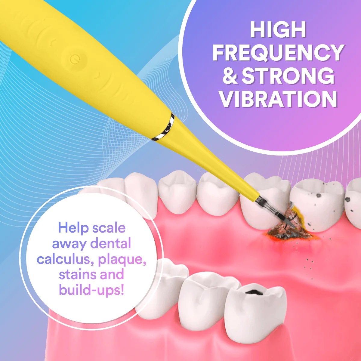 Ultrasonic Tooth Cleaner *BEST SELLER*