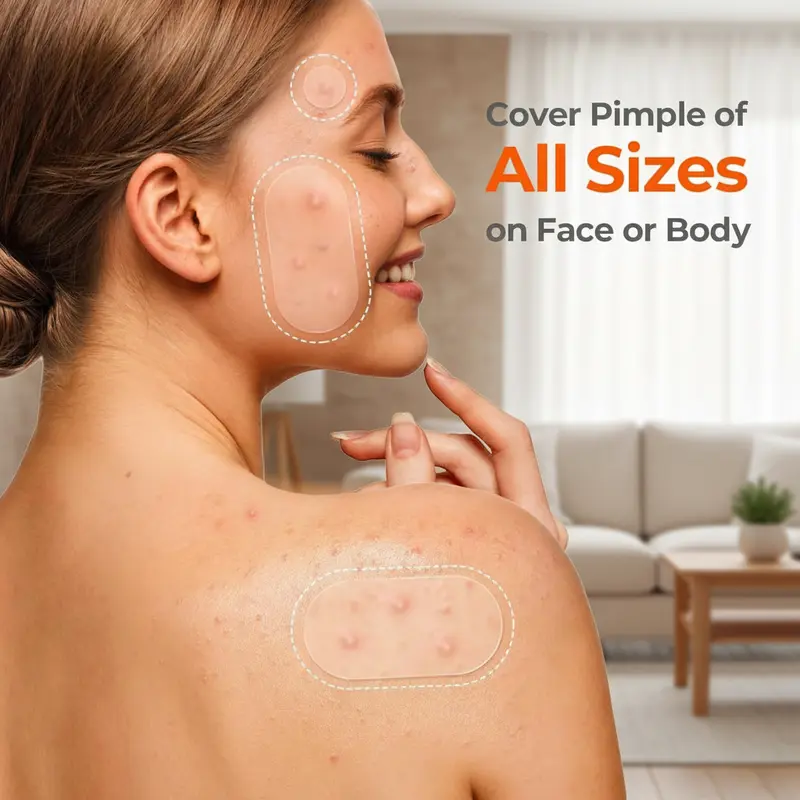 609 Count Pimple Patches for Face, Hydrocolloid Acne Patch Bulk