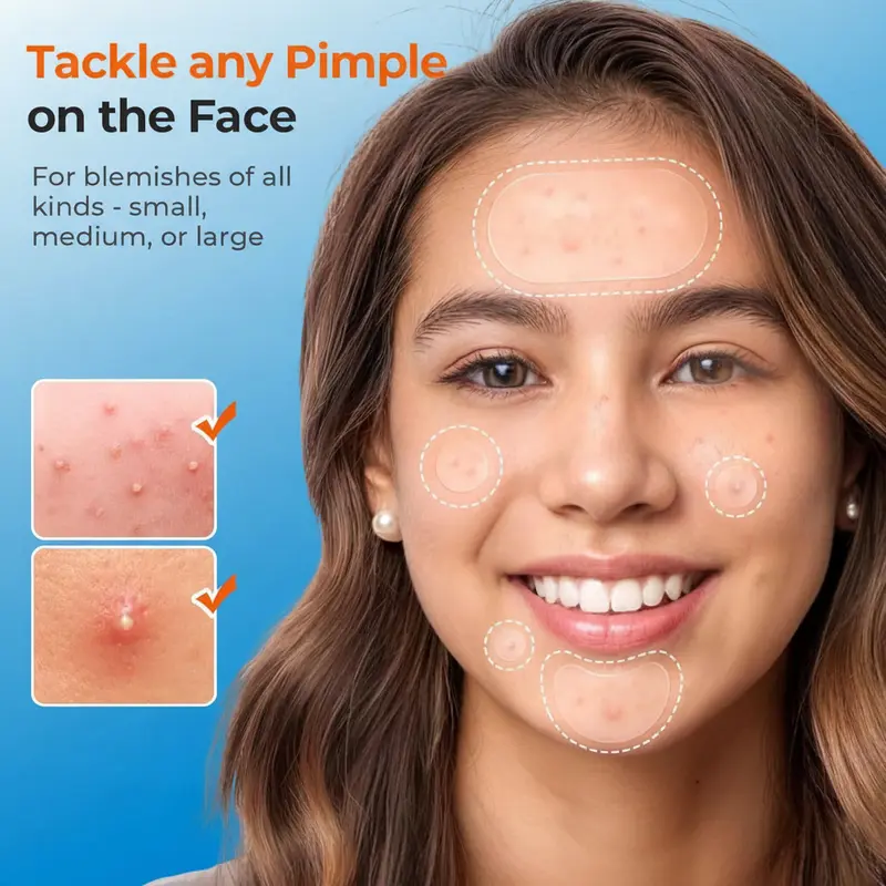 609 Count Pimple Patches for Face, Hydrocolloid Acne Patch Bulk