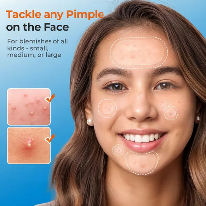 609 Count Pimple Patches for Face, Hydrocolloid Acne Patch Bulk