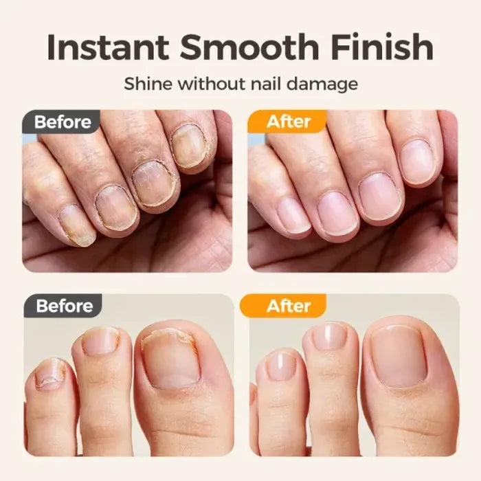 💗LAST DAY SALE 49% OFF⚡50K+ SOLD💕🌟2-in-1 Safe Electric Nail Clipper