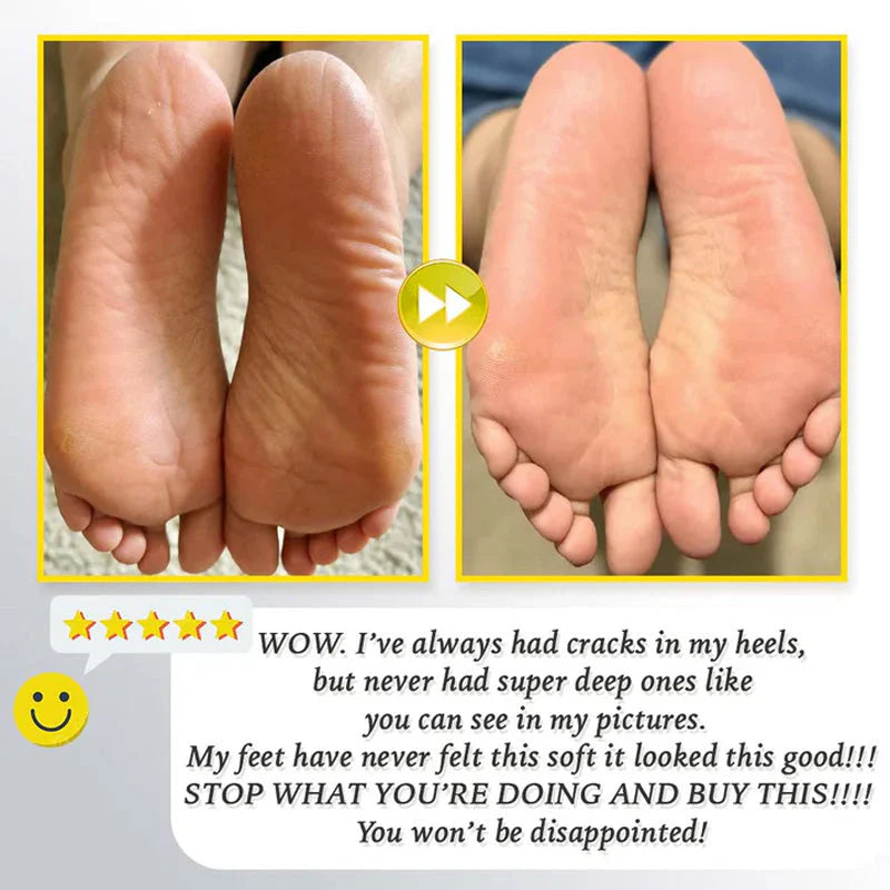 ⏳ Limited-time offer⏳ Rechargeable electric foot file for calluses Two speeds and removable sanding head USB charging Available in four colours