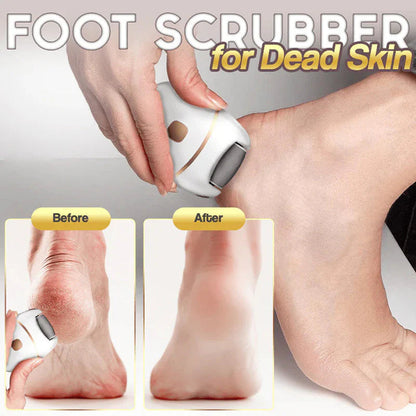 ⏳ Limited-time offer⏳ Rechargeable electric foot file for calluses Two speeds and removable sanding head USB charging Available in four colours