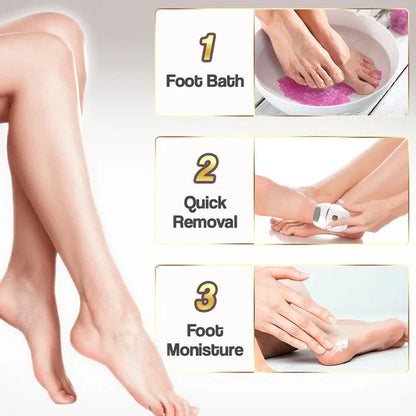 ⏳ Limited-time offer⏳ Rechargeable electric foot file for calluses Two speeds and removable sanding head USB charging Available in four colours