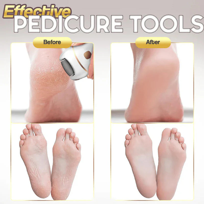 ⏳ Limited-time offer⏳ Rechargeable electric foot file for calluses Two speeds and removable sanding head USB charging Available in four colours