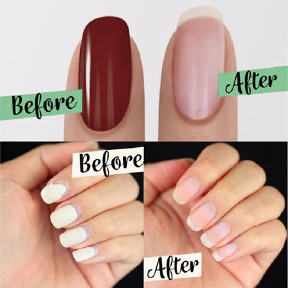 🥳2026 HOT SALE🥳💞50K+ SOLD!🌿🛡️ 50% OFF! Magic Gel Remover – Fast‑acting, gentle on nails. 💎✨