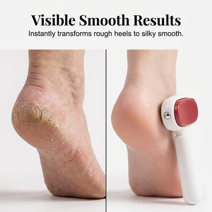 ✨🔥Double-Sided Foot Scraper for Callus Removal