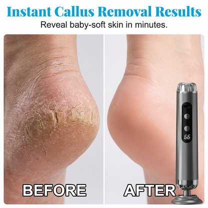Multi-Function Electric Foot Grinder with 5 Speeds