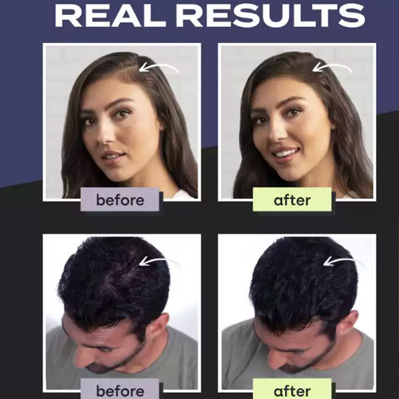 ✨ Hair Building Fibers Kit for an Instantly Fuller-Looking Style
